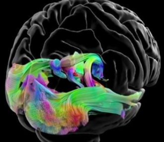 The Amazing Brain: Mapping Brain Circuits in Vivid Color